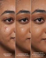 Blemish Defeat'r BHA Spot-Targeting Gel - Image 2